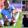 Erling Haaland Injury Man City